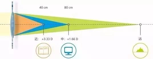 本周六，三焦点晶体植入手术应用研讨会暨老视门诊成立